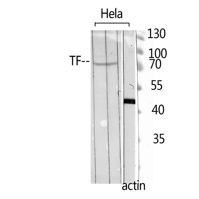 Western Blot - Anti-TF Antibody (C30311) - Antibodies.com