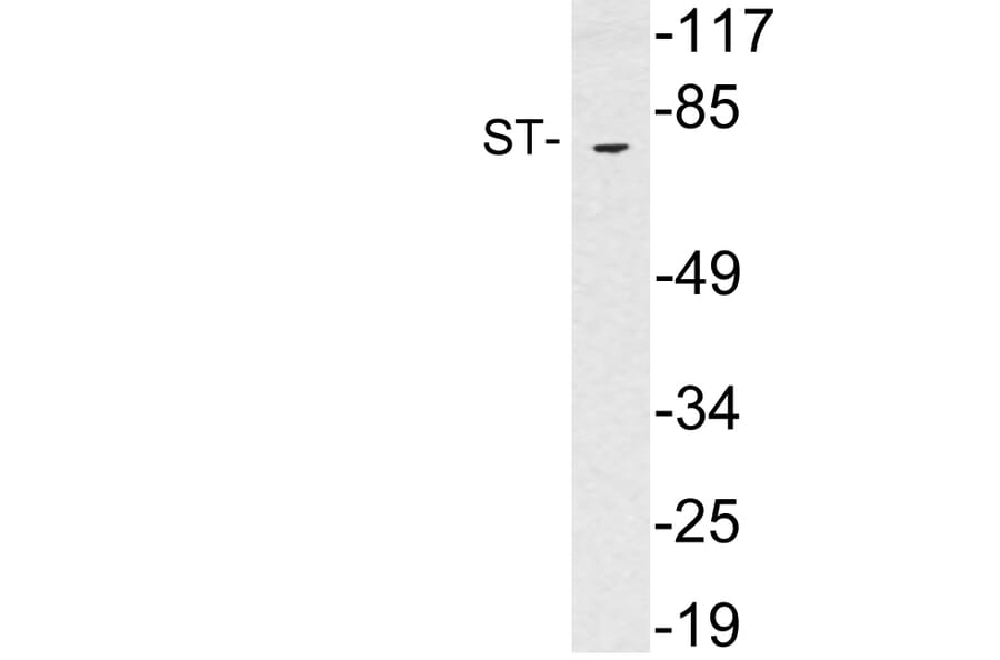 Western Blot - Anti-ST Antibody (R12-2367) - Antibodies.com