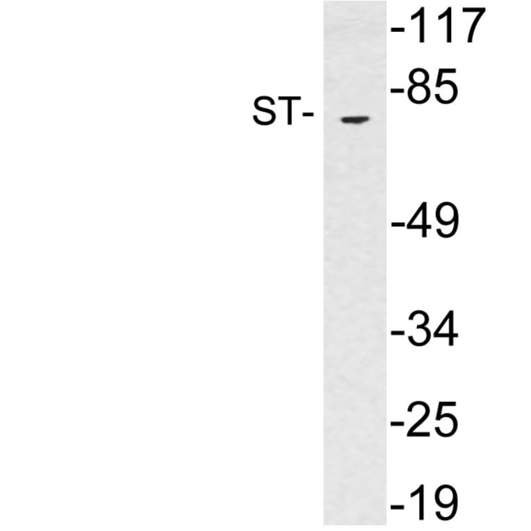 Western Blot - Anti-ST Antibody (R12-2367) - Antibodies.com