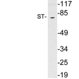 Western Blot - Anti-ST Antibody (R12-2367) - Antibodies.com