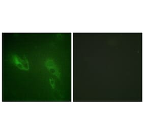 Immunofluorescence - Anti-IR Antibody (B0492) - Antibodies.com