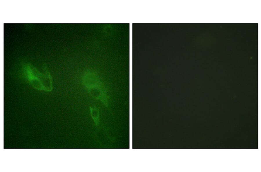 Immunofluorescence - Anti-IR Antibody (B0492) - Antibodies.com