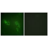 Immunofluorescence - Anti-IR Antibody (B0492) - Antibodies.com