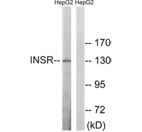 Western Blot - Anti-IR Antibody (B8116) - Antibodies.com