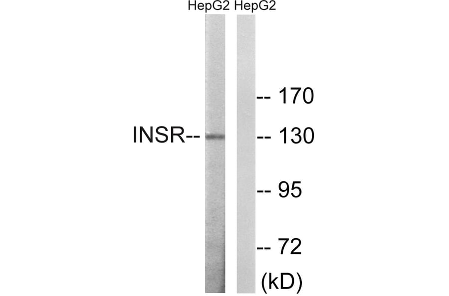 Western Blot - Anti-IR Antibody (B8116) - Antibodies.com