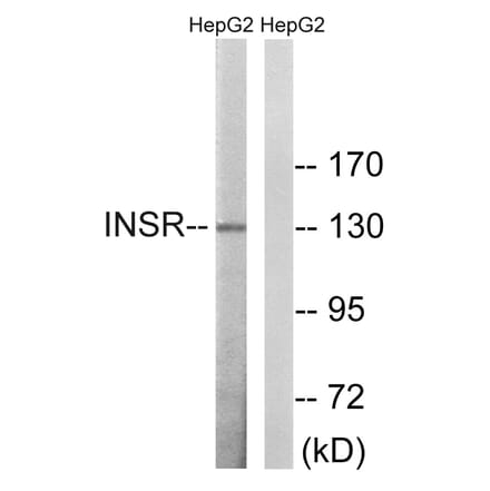 Western Blot - Anti-IR Antibody (B8116) - Antibodies.com