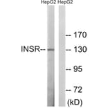 Western Blot - Anti-IR Antibody (B8116) - Antibodies.com