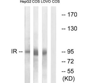 Western Blot - Anti-IR Antibody (B0494) - Antibodies.com