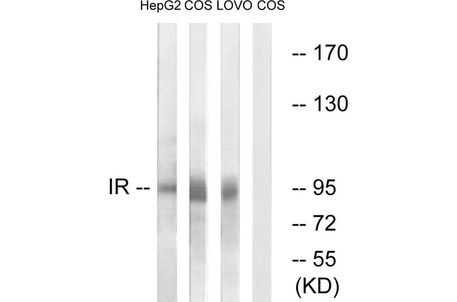 Western Blot - Anti-IR Antibody (B0494) - Antibodies.com
