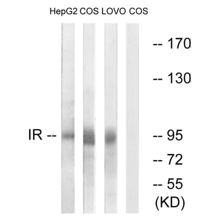 Western Blot - Anti-IR Antibody (B0494) - Antibodies.com