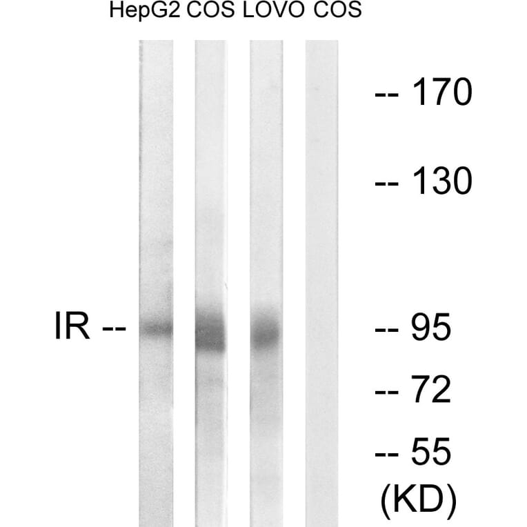 Western Blot - Anti-IR Antibody (B0494) - Antibodies.com