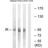 Western Blot - Anti-IR Antibody (B0494) - Antibodies.com