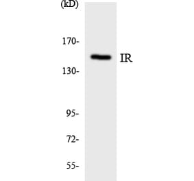 Western Blot - Anti-IR Antibody (R12-2932) - Antibodies.com