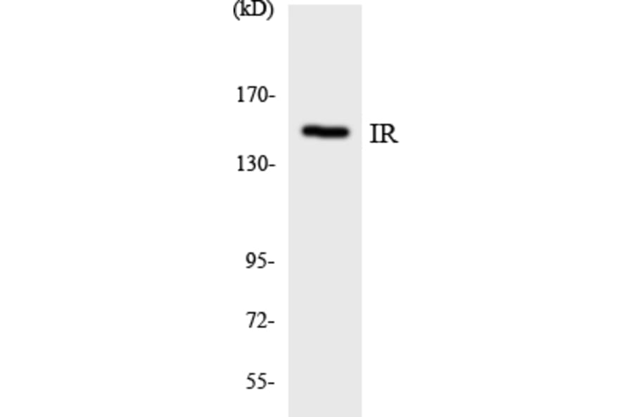 Western Blot - Anti-IR Antibody (R12-2932) - Antibodies.com