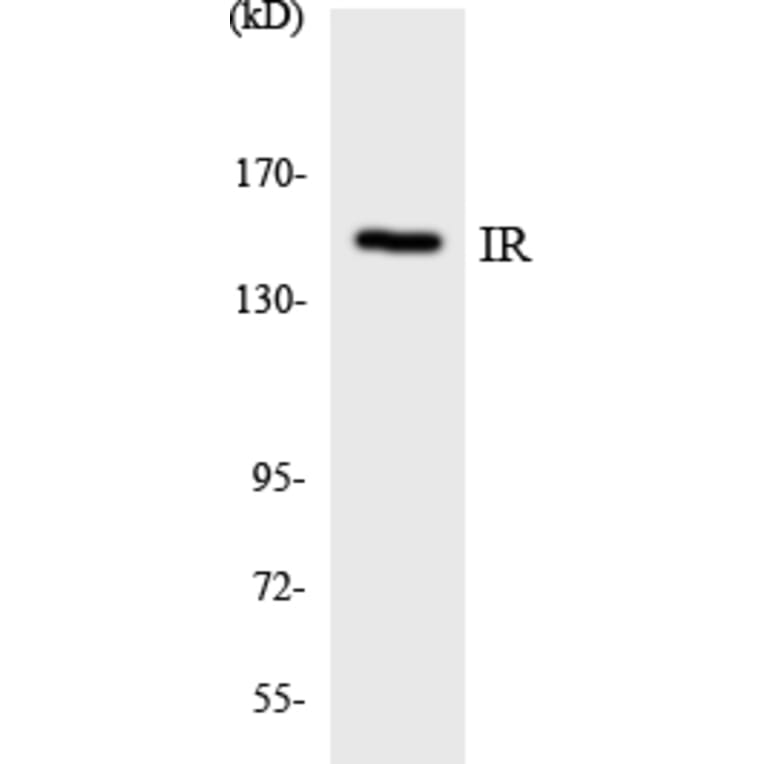 Western Blot - Anti-IR Antibody (R12-2932) - Antibodies.com