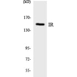 Western Blot - Anti-IR Antibody (R12-2932) - Antibodies.com