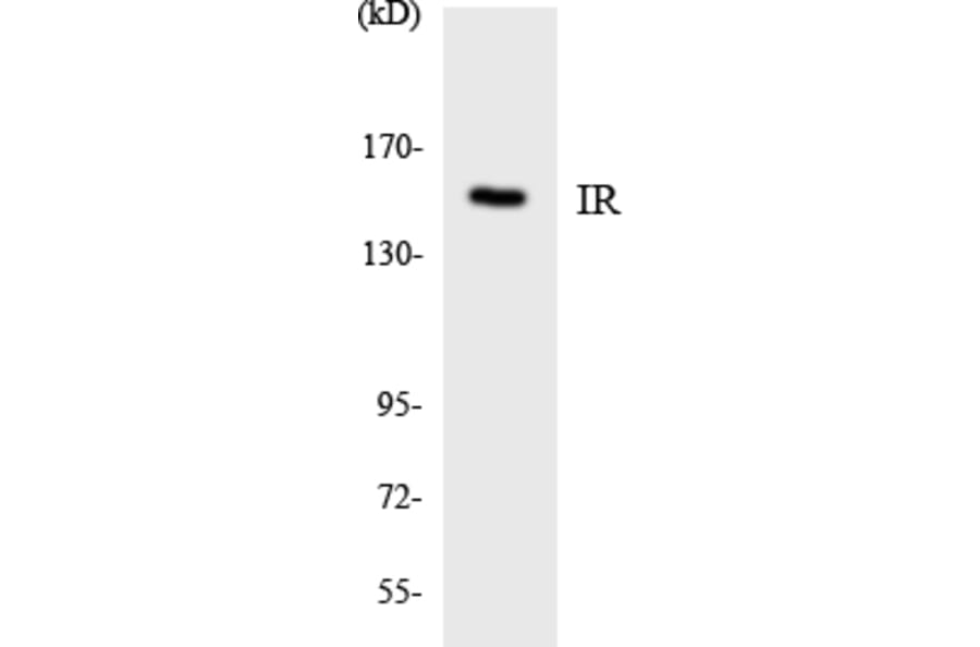 Western Blot - Anti-IR Antibody (R12-2933) - Antibodies.com