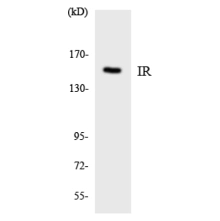 Western Blot - Anti-IR Antibody (R12-2933) - Antibodies.com