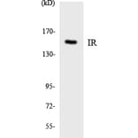 Western Blot - Anti-IR Antibody (R12-2933) - Antibodies.com