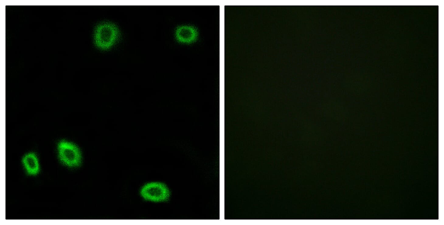 Immunofluorescence analysis of HUVEC cells using Anti-OR5L1 + OR5L2 Antibody. The right hand panel represents a negative control, where the antibody was pre-incubated with the immunising peptide.