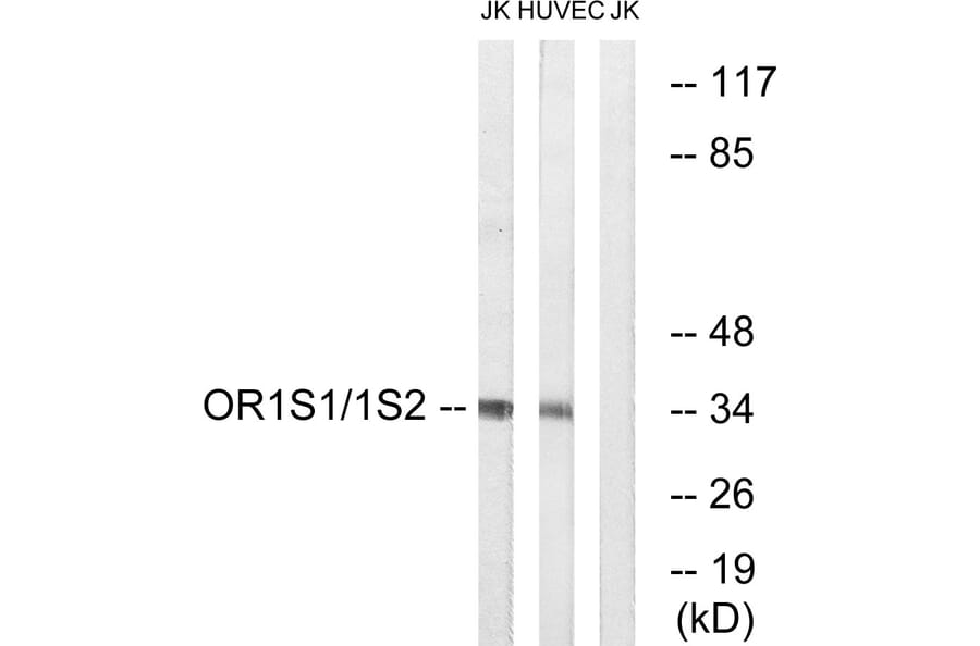 Western Blot - Anti-OR1S1 + OR1S2 Antibody (G534) - Antibodies.com