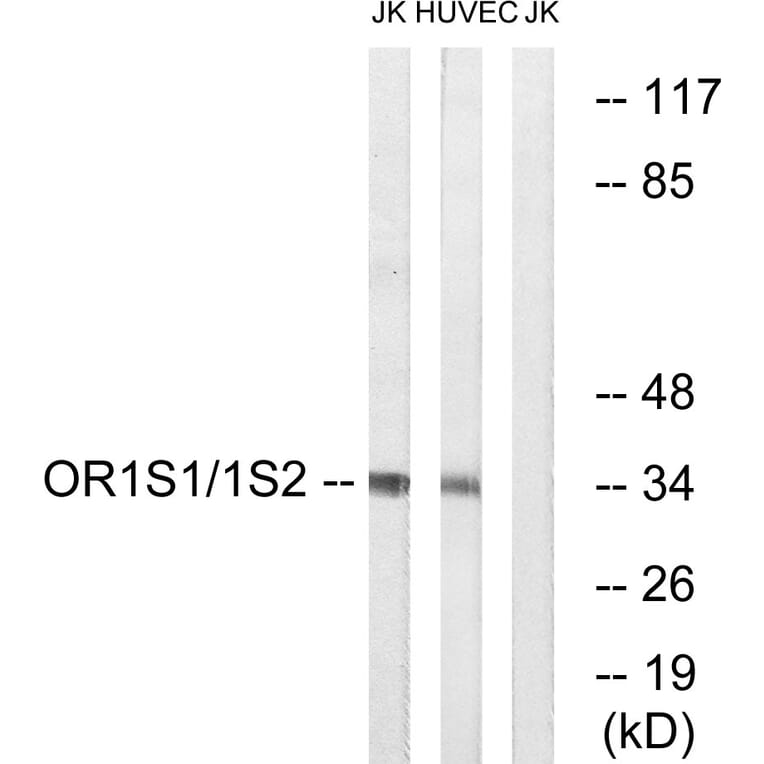 Western Blot - Anti-OR1S1 + OR1S2 Antibody (G534) - Antibodies.com