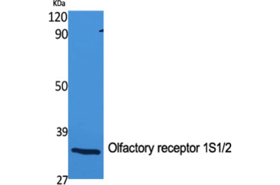 Western Blot - Anti-OR1S1 + OR1S2 Antibody (G534) - Antibodies.com