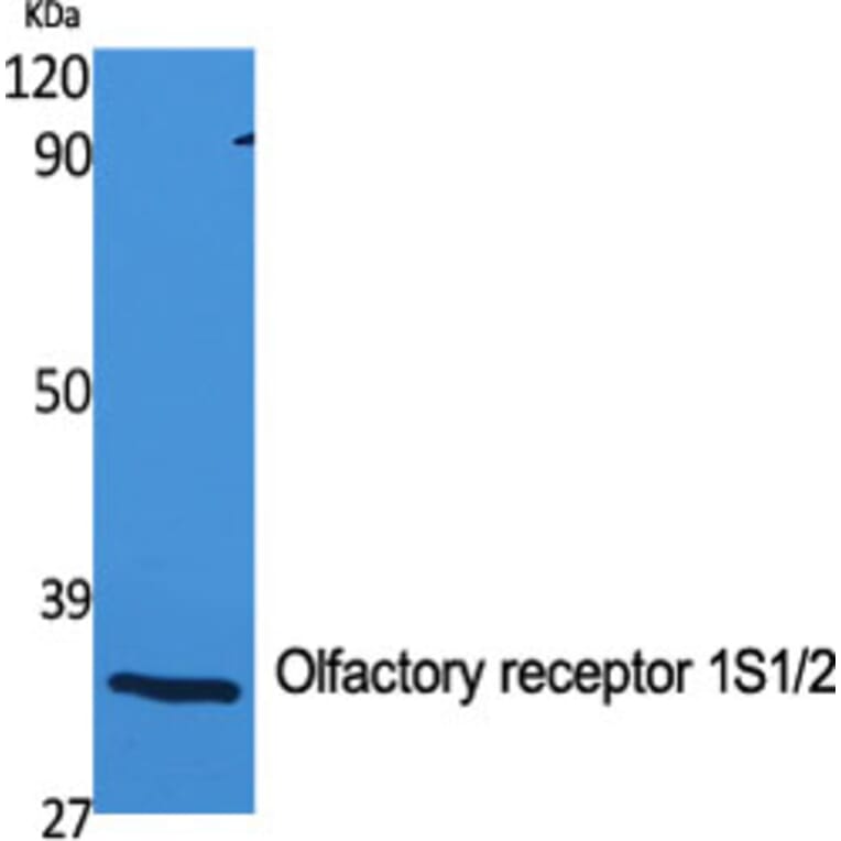 Western Blot - Anti-OR1S1 + OR1S2 Antibody (G534) - Antibodies.com