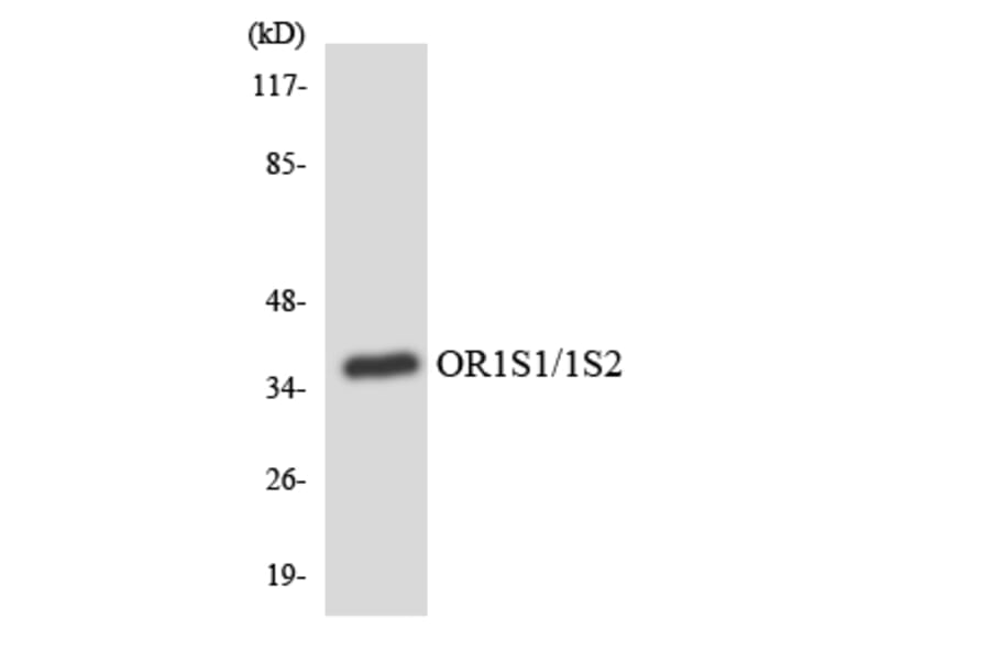 Western Blot - Anti-OR1S1 + OR1S2 Antibody (R12-3155) - Antibodies.com