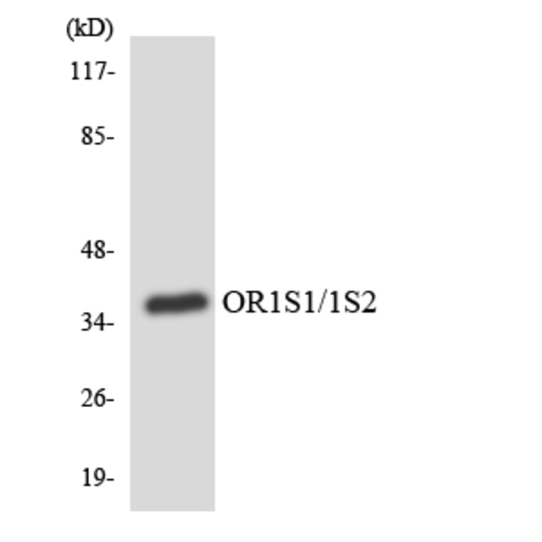 Western Blot - Anti-OR1S1 + OR1S2 Antibody (R12-3155) - Antibodies.com