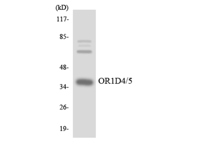 Western Blot - Anti-OR1D4 + OR1D5 Antibody (R12-3153) - Antibodies.com