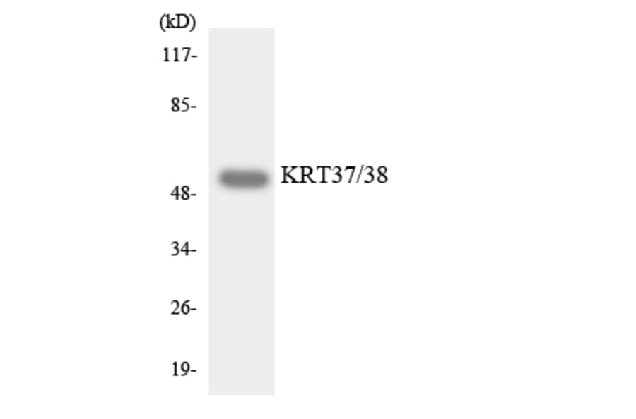 Western Blot - Anti-KRT37 + KRT38 Antibody (R12-2958) - Antibodies.com