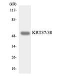 Western Blot - Anti-KRT37 + KRT38 Antibody (R12-2958) - Antibodies.com