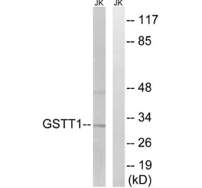 Western Blot - Anti-GSTT1 + GSTT4 Antibody (C15930) - Antibodies.com