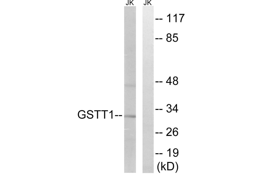 Western Blot - Anti-GSTT1 + GSTT4 Antibody (C15930) - Antibodies.com