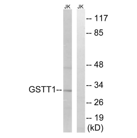 Western Blot - Anti-GSTT1 + GSTT4 Antibody (C15930) - Antibodies.com