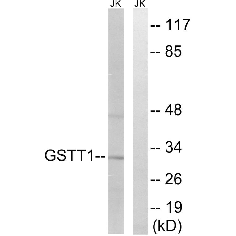 Western Blot - Anti-GSTT1 + GSTT4 Antibody (C15930) - Antibodies.com