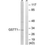 Western Blot - Anti-GSTT1 + GSTT4 Antibody (C15930) - Antibodies.com