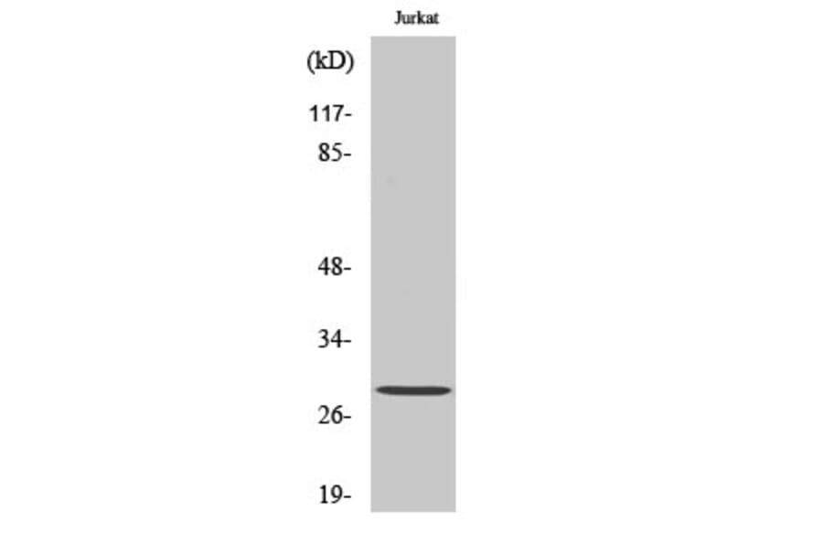 Western Blot - Anti-GSTT1 + GSTT4 Antibody (C15930) - Antibodies.com