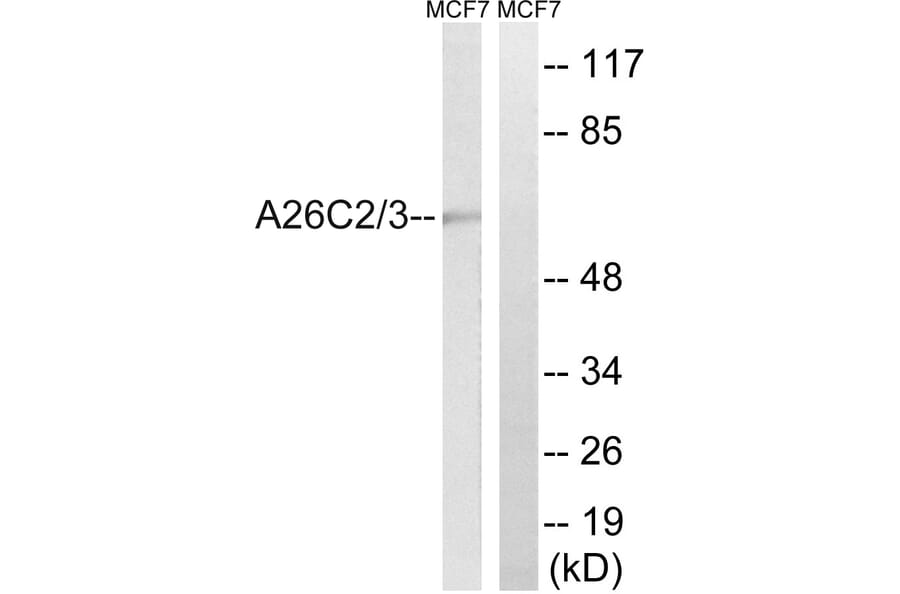Western Blot - Anti-A26C2 + A26C3 Antibody (C17979) - Antibodies.com