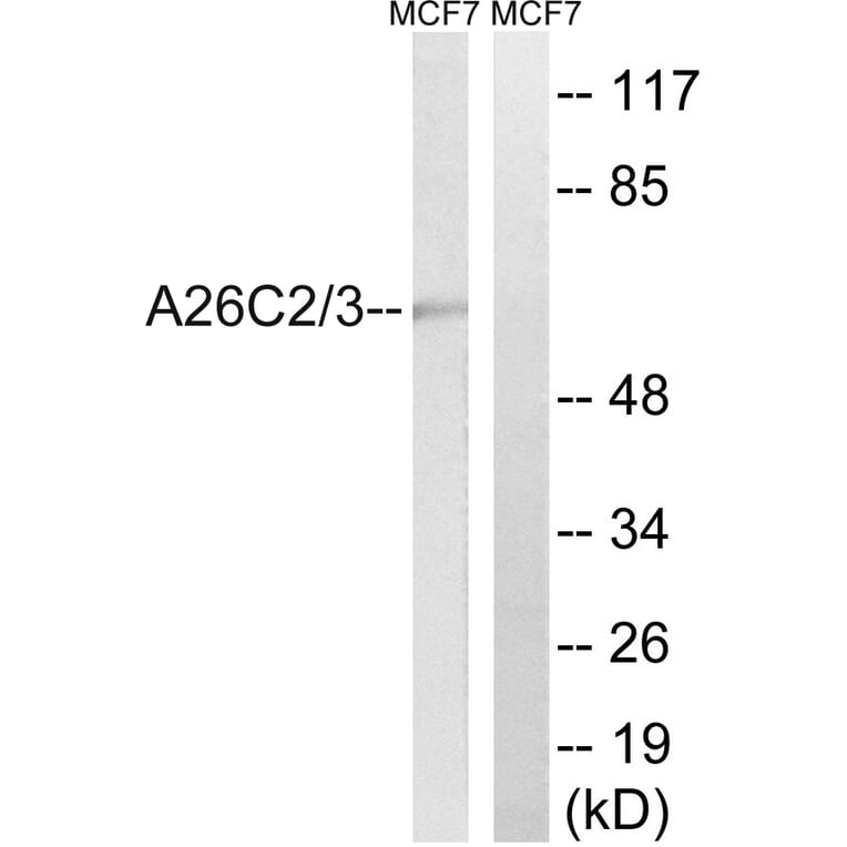 Western Blot - Anti-A26C2 + A26C3 Antibody (C17979) - Antibodies.com