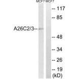 Western Blot - Anti-A26C2 + A26C3 Antibody (C17979) - Antibodies.com