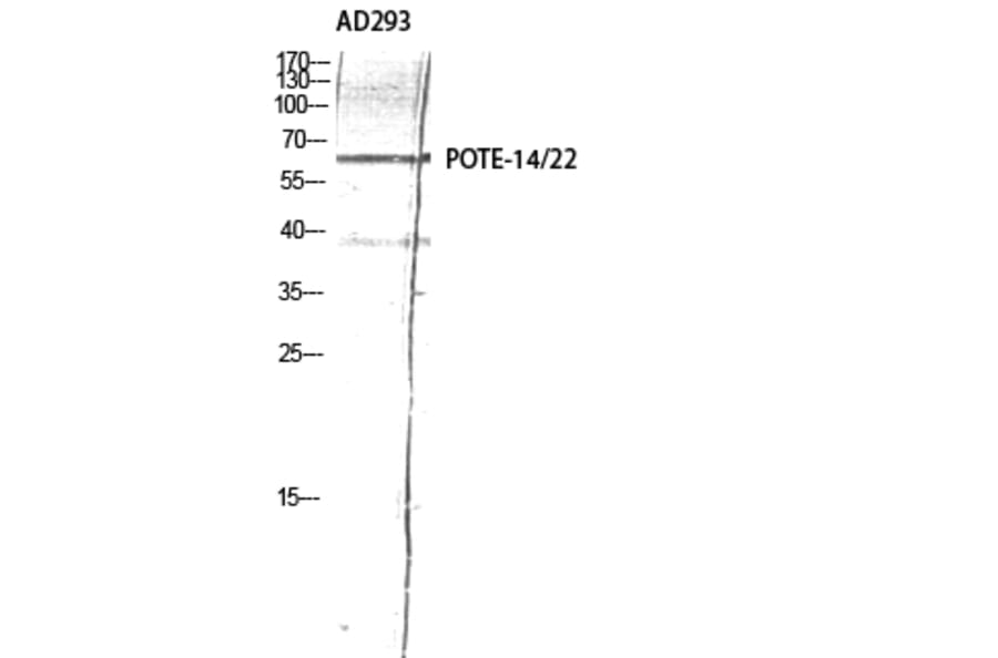 Western Blot - Anti-A26C2 + A26C3 Antibody (C17979) - Antibodies.com