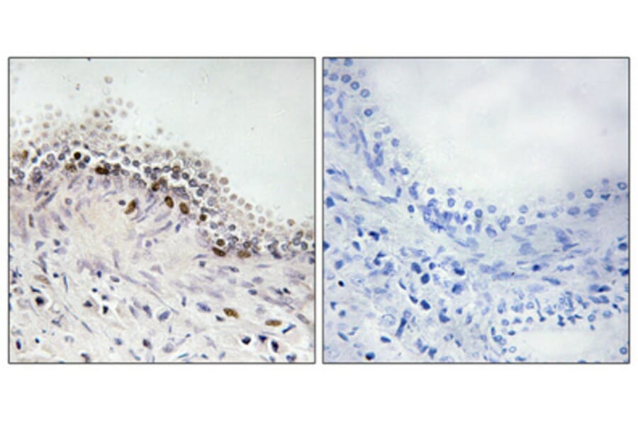 Immunohistochemistry - Anti-DNA Ligase 4 Antibody (B1197) - Antibodies.com