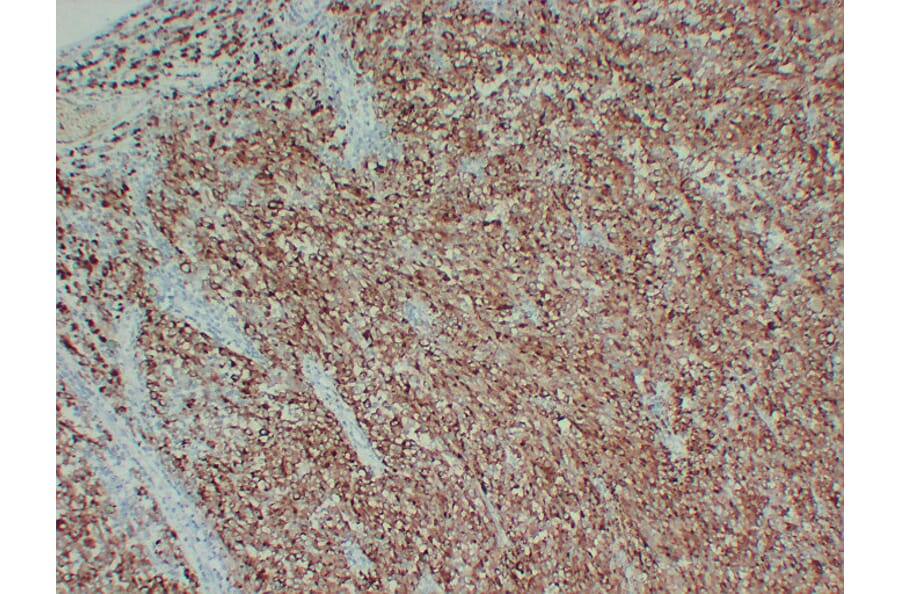 Immunohistochemistry - Anti-Tyrosinase Antibody (V0136) - Antibodies.com