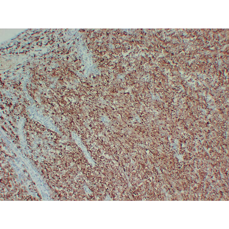 Immunohistochemistry - Anti-Tyrosinase Antibody (V0136) - Antibodies.com