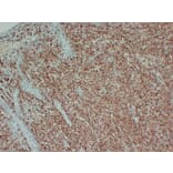 Immunohistochemistry - Anti-Tyrosinase Antibody (V0136) - Antibodies.com