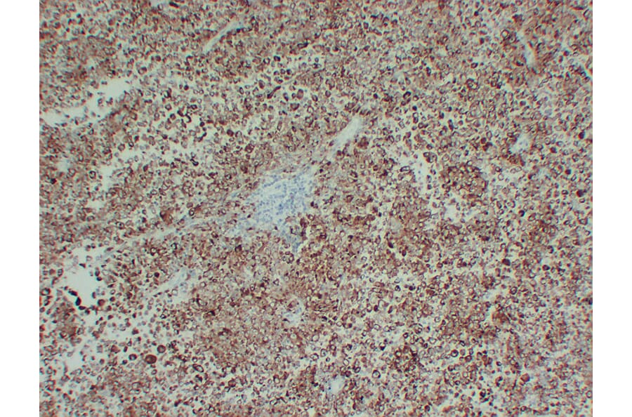Immunohistochemistry - Anti-Tyrosinase Antibody (V0136) - Antibodies.com