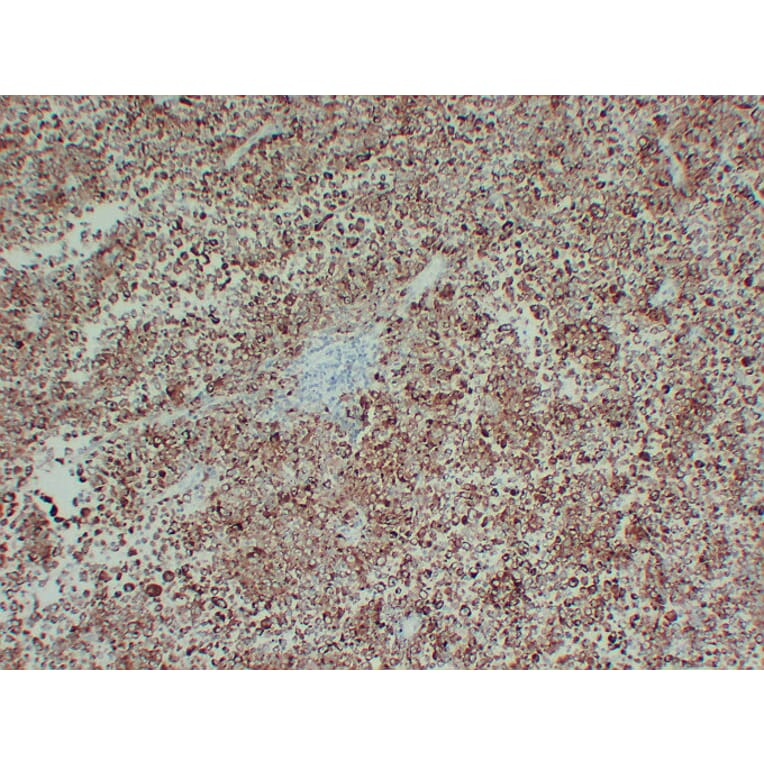 Immunohistochemistry - Anti-Tyrosinase Antibody (V0136) - Antibodies.com