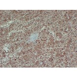 Immunohistochemistry - Anti-Tyrosinase Antibody (V0136) - Antibodies.com